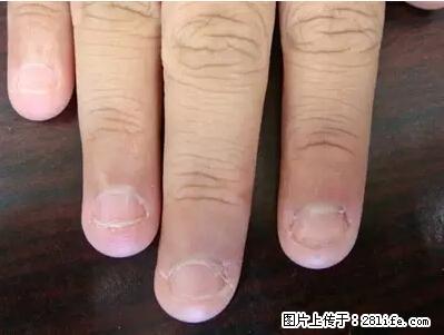 剪指甲、挖耳屎，这些日常小动作竟隐藏大危害！ - 哈密生活资讯 - 哈密28生活网 hami.28life.net